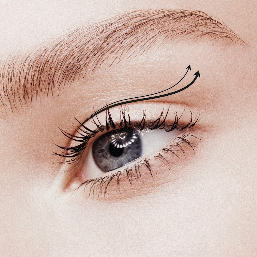 Eye lift