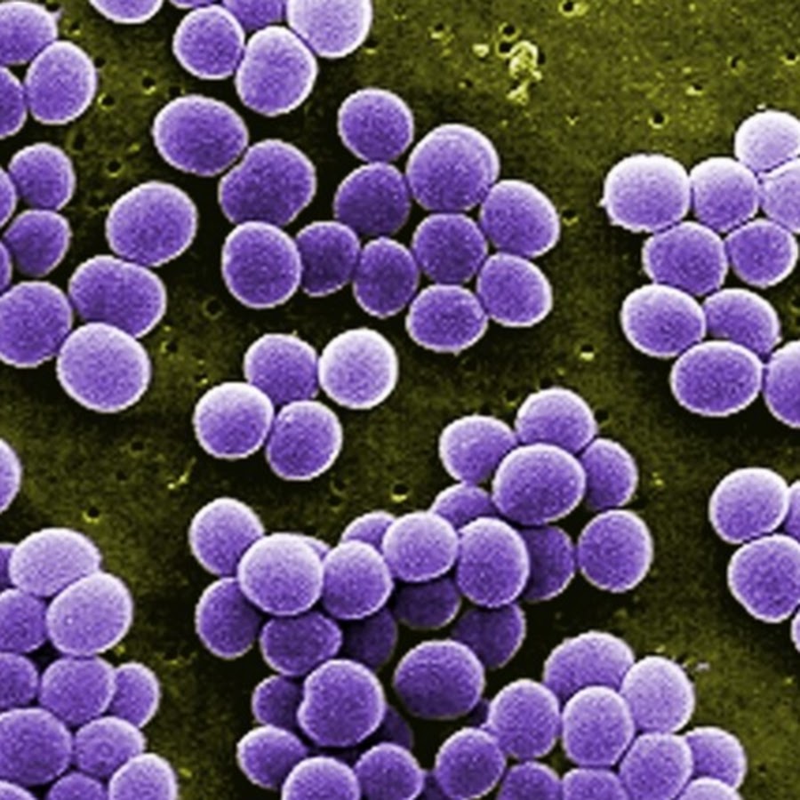 Staphylococcus aureus 3. Стрептококк ауреус. Метициллин-резистентный золотистый стафилококк. Micrococcus flavus.
