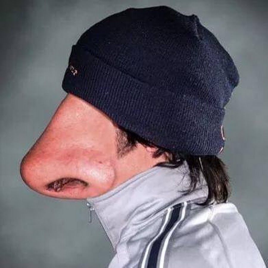 Странный шлем на голове