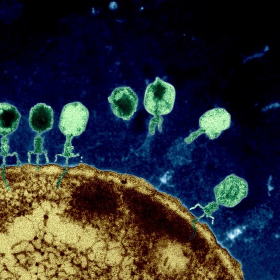 Атакующие клетки. Бактериофаг микроскопия. Т4 бактериофаг микроскоп. Вирус бактериофаг под микроскопом. Бактериофаг ретровирус.