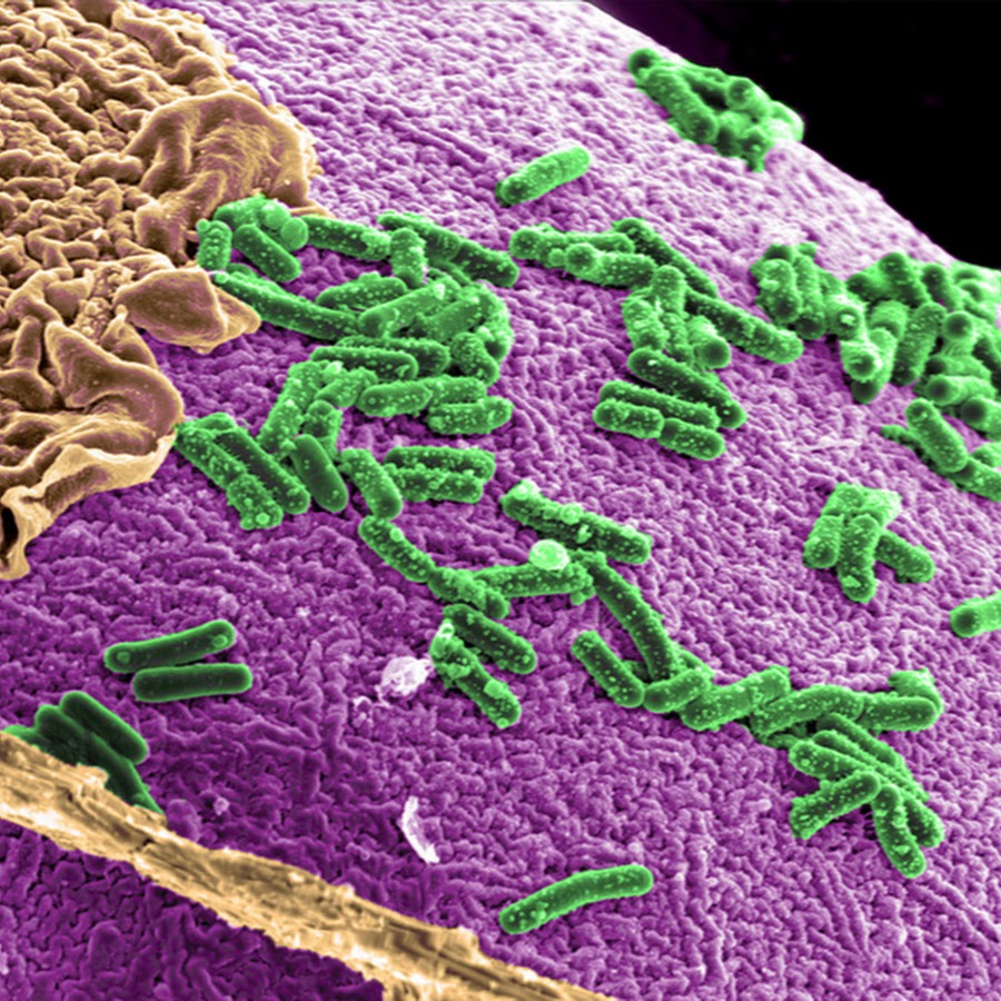 Кишечная микрофлора. Бактерии микробиота кишечника. Микробиом человека микробиология. Кишечник бактерии микробиом. Симбионтная микрофлора.
